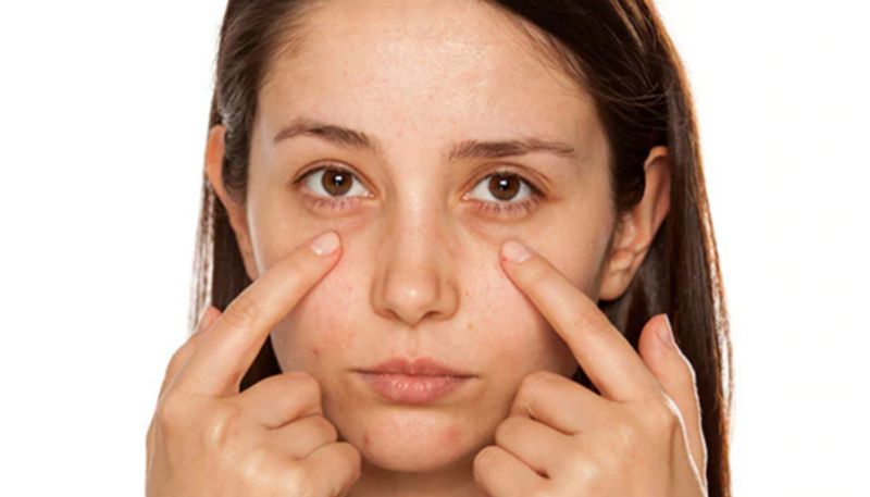 tips to remove dark circles under the eyes azn 