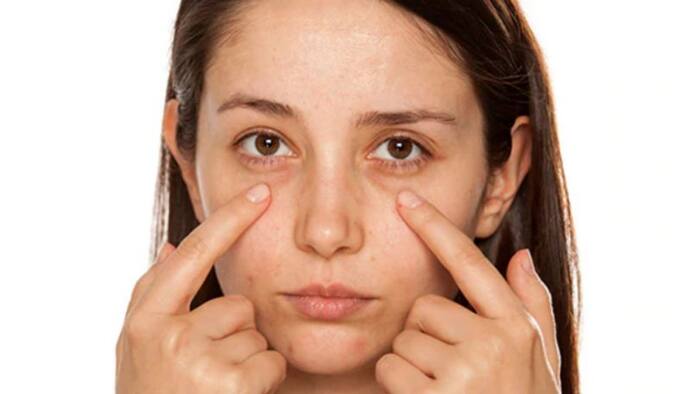 dark circles