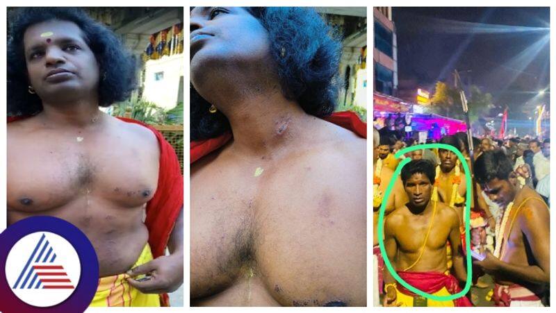 Begaluru Festival Chemical spray on Jnanendra who was Karaga carrying sat