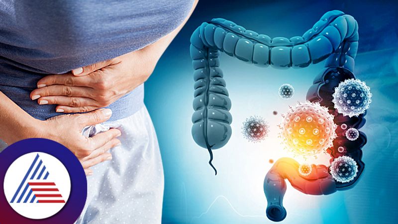 Colon Cancer Symptoms Should Be Recognized On Time Know Here