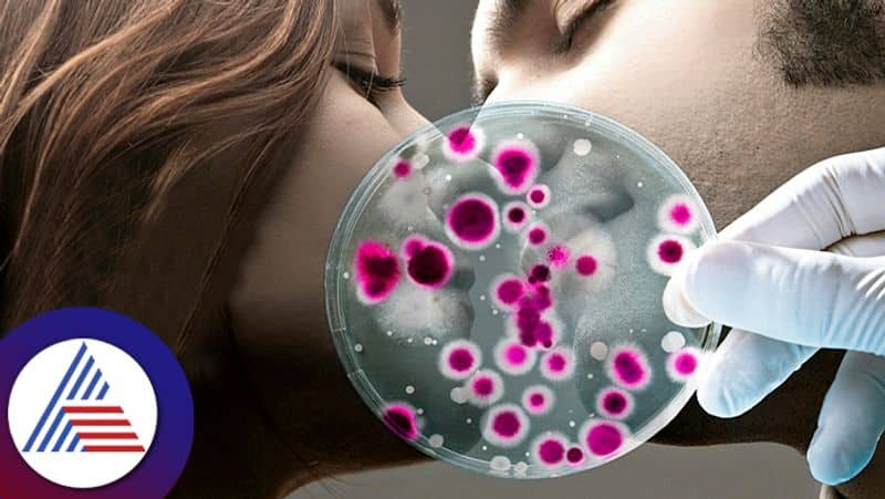 What is Kissing disease and its symptoms 