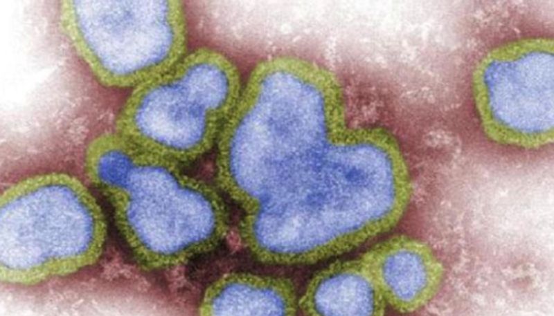 First death from H3N8 confirmed in China know about this virus azn 