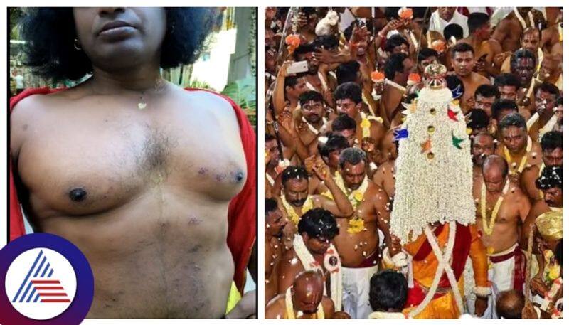 Begaluru Festival Chemical spray on Jnanendra who was Karaga carrying sat