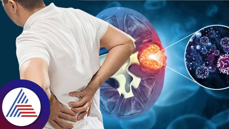 These are the best home remedies for Gallstones