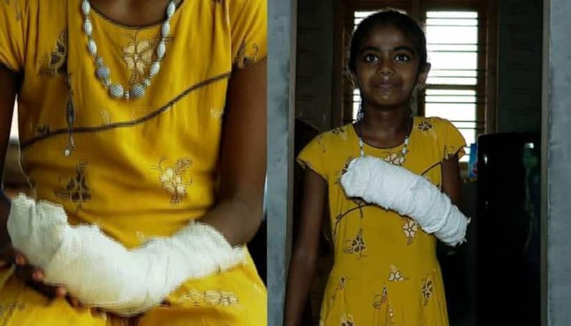 Kerala girl loses finger mobility due to doctor's negligence; Case registered