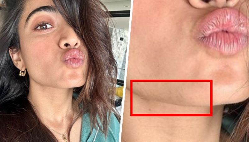 Rashmika Mandanna gets trolled for 'facial hair' in her latest selfie; netizens share some close-up photos RBA