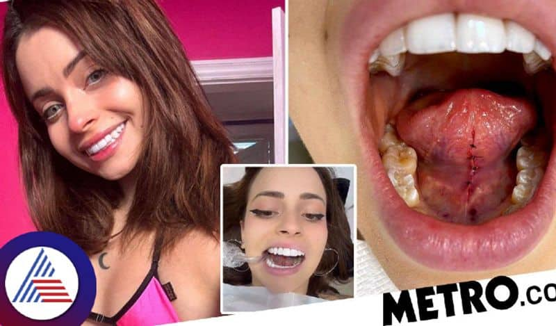 Influencer gets part of tongue cut to get better at kissing, calls it best decision ever Vin