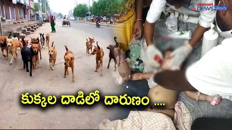 A child died in an attack by stray dogs in Srikakulam