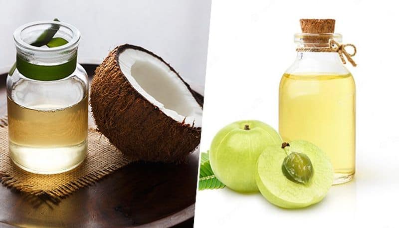 Three indigenous Ayurvedic oils which can help you in reducing hair loss vma