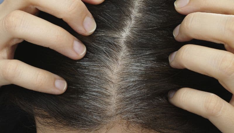 how to get rid of grey hair naturally azn 