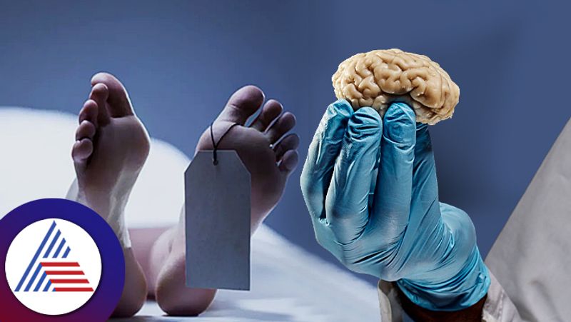 Mysterious Surge Of Activity Detected In The Brains Of Dying People