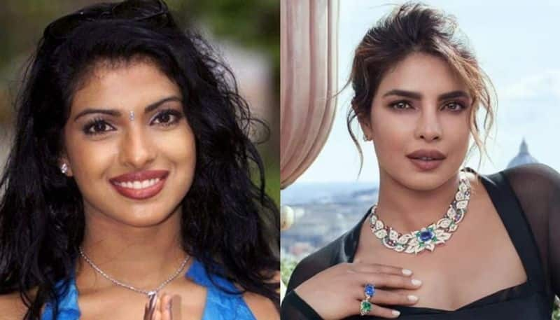 priyanka chopra remember about the depression that she suffered after nose surgery hyp 