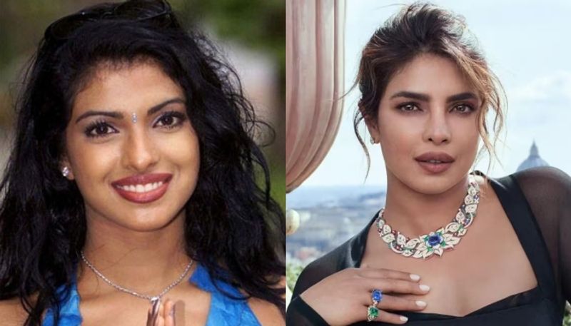 priyanka chopra remember about the depression that she suffered after nose surgery hyp 