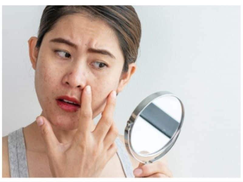 home remediets to get rid of bags under your eyes or swelling rsl