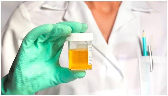 urine