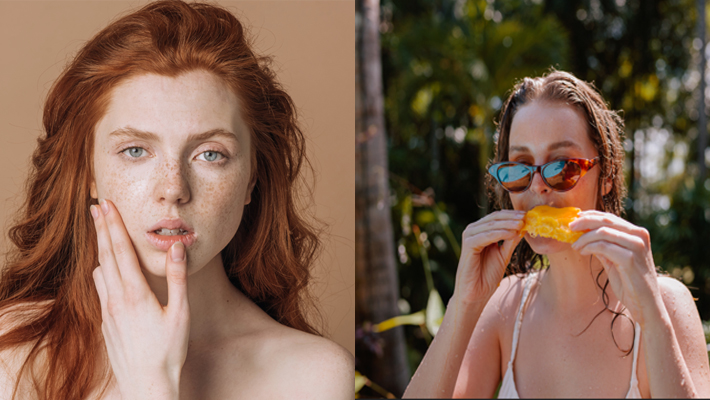 आम खाने के बाद क्या आपको भी चेहरे पर निकल आते हैं मुंहासे, तो आजमाएं ये