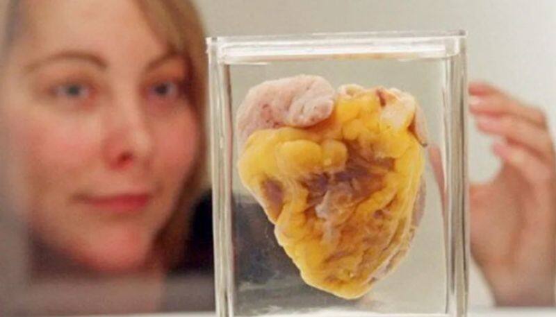 woman sees her own heart after sixteen years in museum, A rare incident - bsb