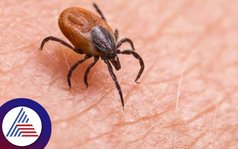 Powassan virus symptoms and how to control it 