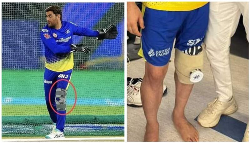 Mahendra Singh Dhoni's knee surgery has been successful says Chennai Super Kings CEO san