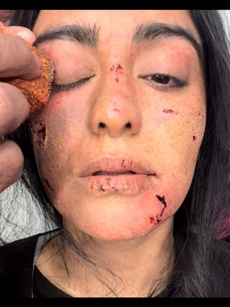 Adah Sharma shares cracked lips pic and reveals being dehydrated for 40 hours on The Kerala Story set sgk