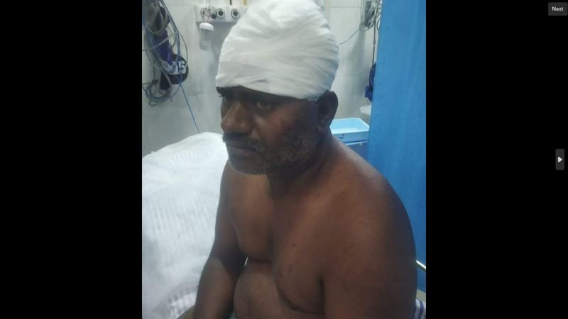 Government doctors stitched a patient's head with an iron nut in Vellore