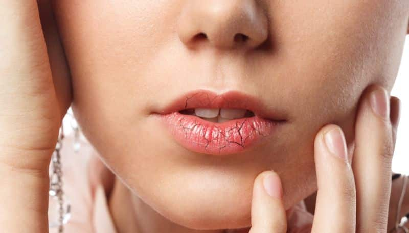 Here are 7 lipcare tips for you this rainy season ADC