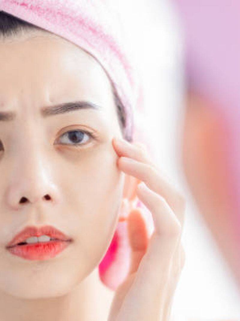 9 best foods that will help in reducing dark circles