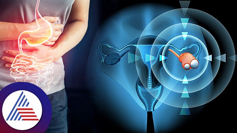 Know All About Ovarian Cysts That Develop During Menstruation roo