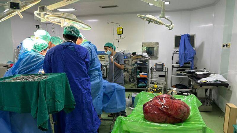 36 kg cancer tumor removed successfully