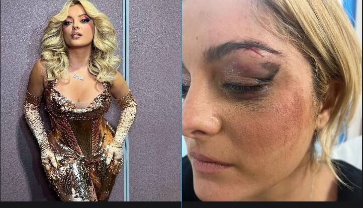 Bebe Rexha 