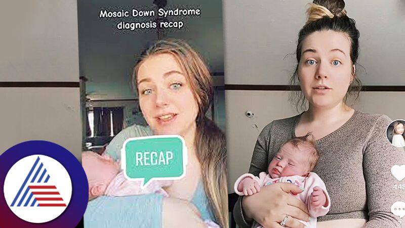 Twenty Three Year Old Mother Of Three Children Diagnosed With Down Syndrome roo