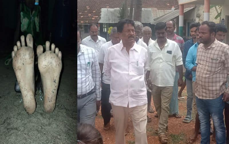 Fungal Skin Infection in Tumakuru childrens MLA MT Krishnappa visits the school gvd