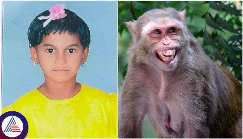 Monkey attacks Muslim girl in Dharwad Leg seriously injured sat