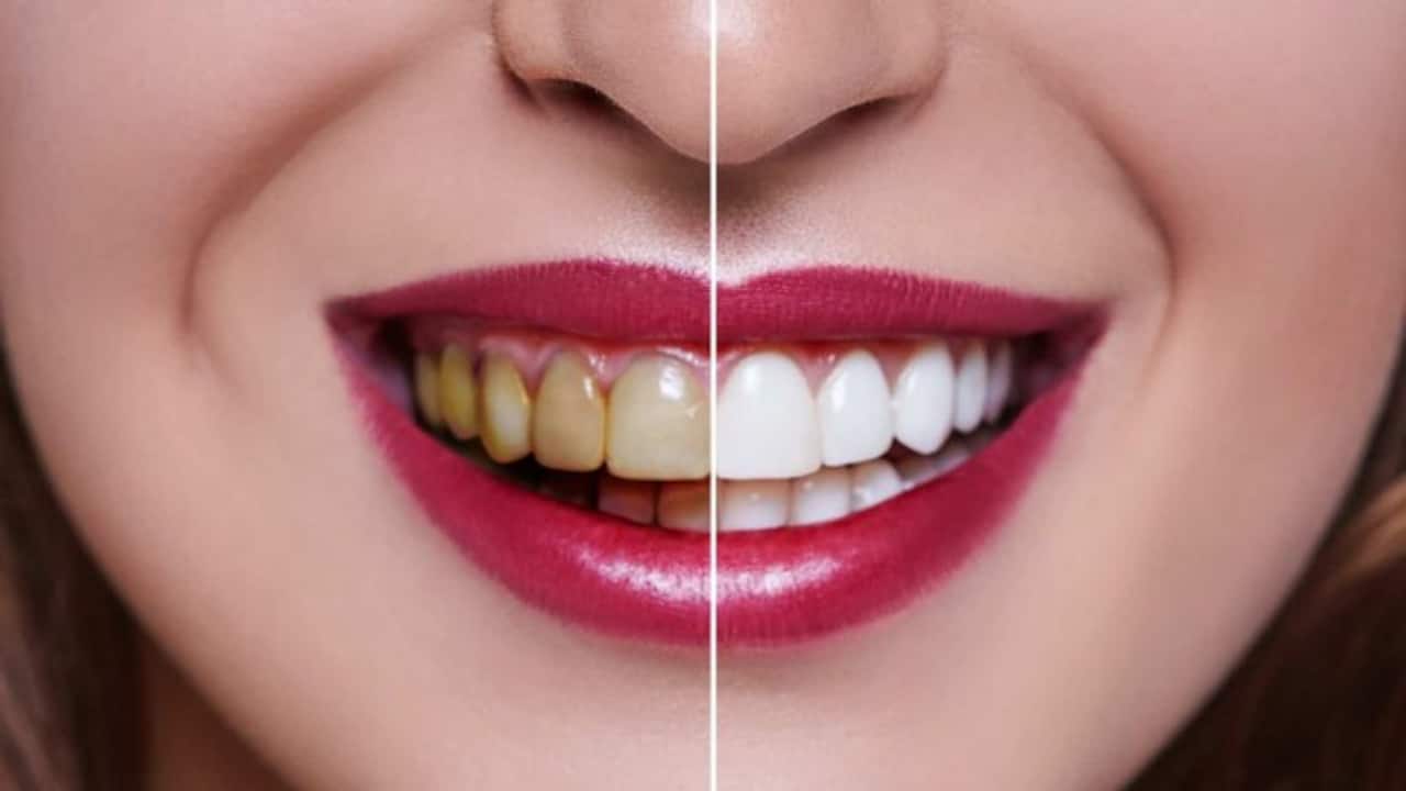 Effective home remedies for removing yellow stains from teeth | Asianet  Newsable