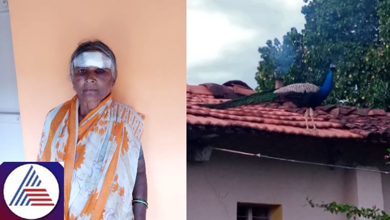 Karnataka: Peacock attacks woman in Chennapattana; receives severe injuries on forehead, eyes vkp