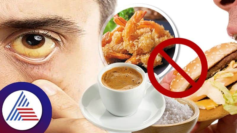 Know about the foods to avoid in jaundice to recover quickly pav