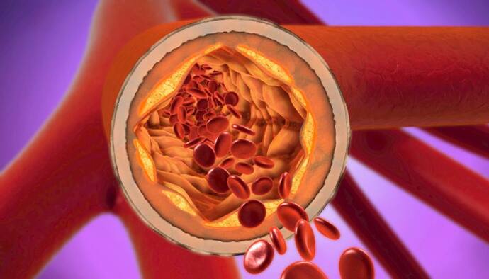 Cholesterol