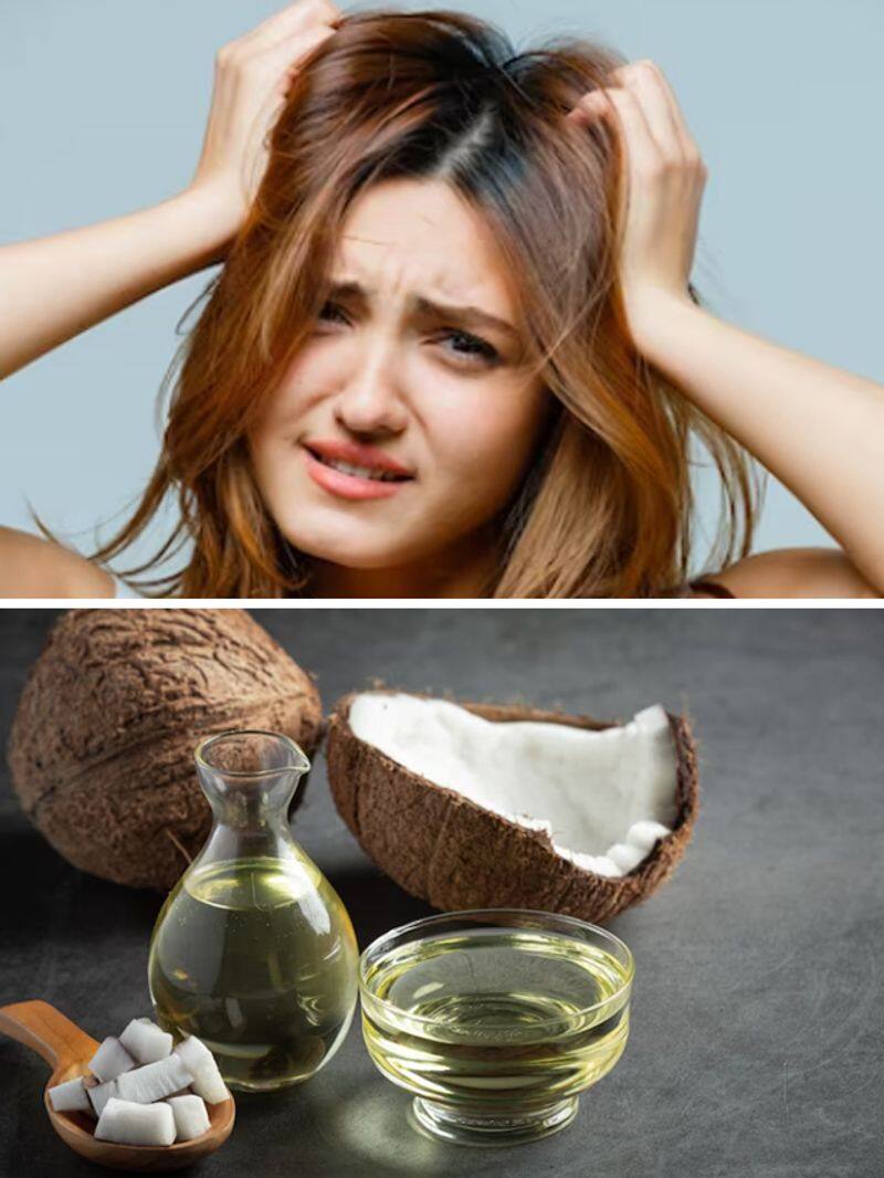 7 best natural home remedies for dandruff pav 