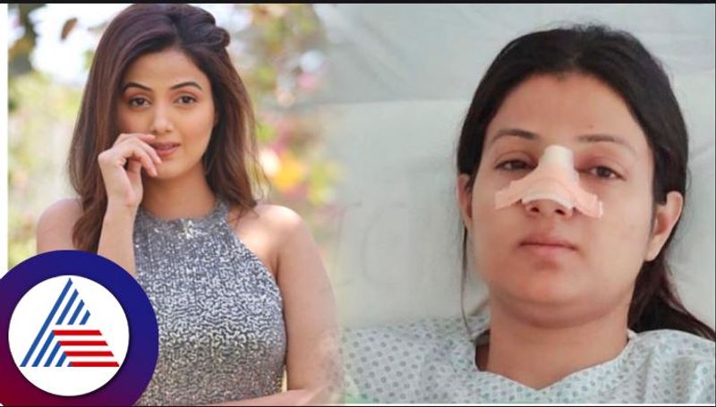 Kismat Ki Lakiro Se lead actress Sumati Singh talks about nose operation vcs