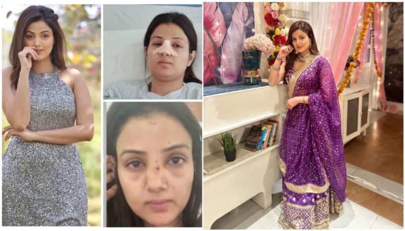 Actress Sumati Singh talks about her emotional distress after nose surgery