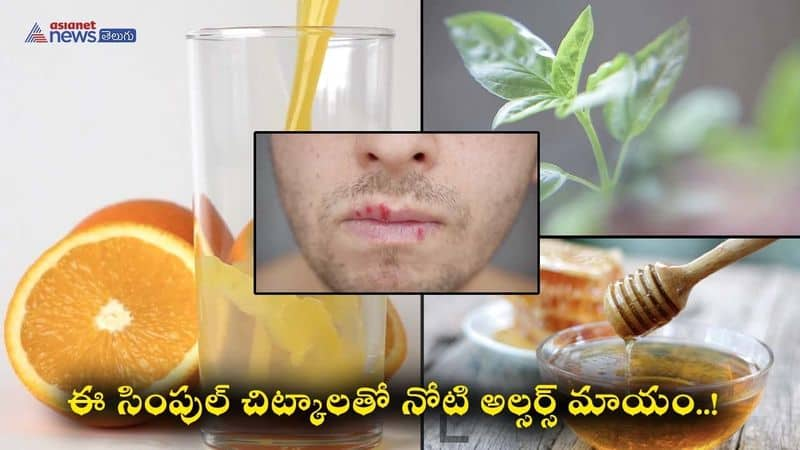 Effective Home Remedies for Fast Relief from Painful Mouth Ulcers