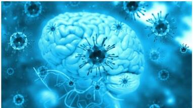 Encephalitis confirmed in a first-grade student in Ernakulam Encephalitis confirmed in a first-grade student in Ernakulam