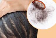 vitamin deficiency causes hair fall common vitamin deficiencies