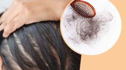 vitamin deficiency causes hair fall common vitamin deficiencies