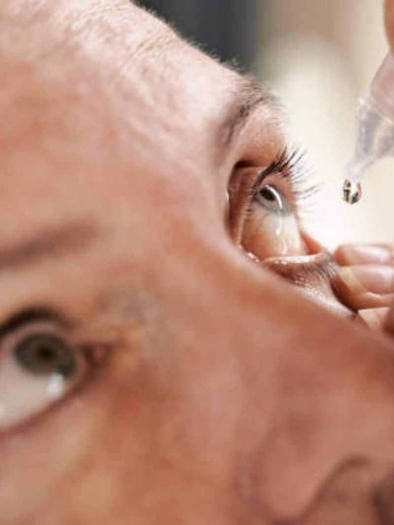 know about these tips to treat conjunctivitis during monsoon hyp