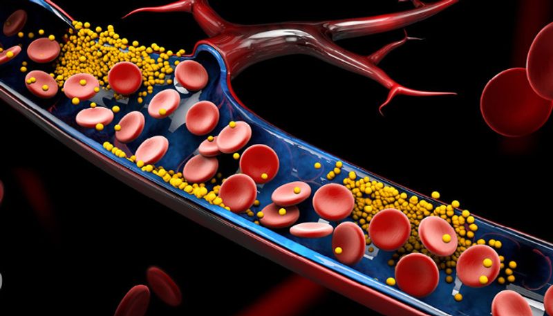 Morning Drinks To Naturally Lower Bad Blood Cholesterol Levels azn 