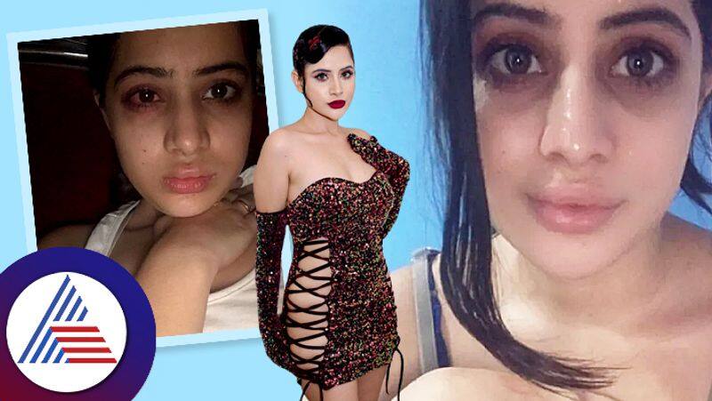 Uorfi Javed Who have Been Open About Getting Plastic Surgery looks withoug make up rao