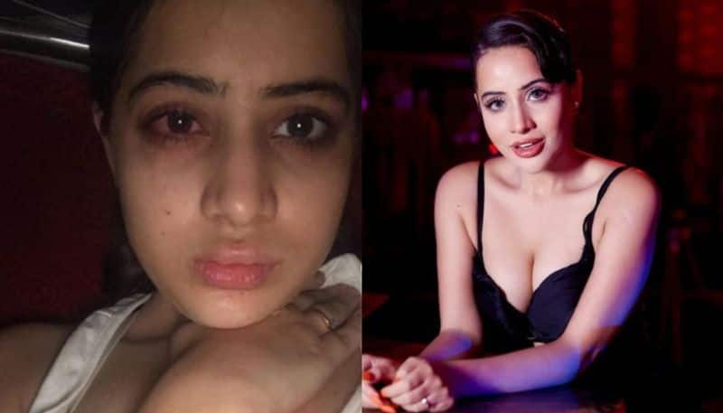 uorfi javed shares pictures that took after doing lip filler hyp