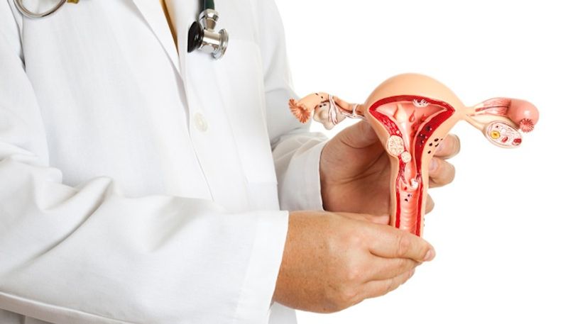 What is Uterine fibroids? Busting myths related to non-cancerous growth in the uterus RBA