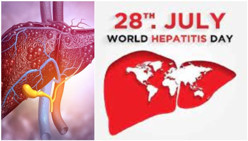 Know the difference between Hepatitis A, B, C, D and E What can be done to protect liver btb